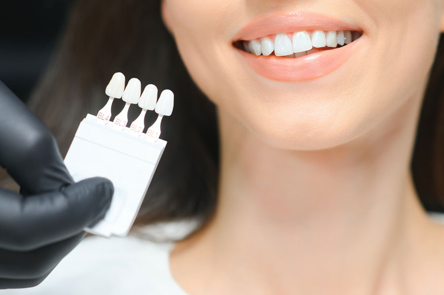 Dentist checking teeth whitening results