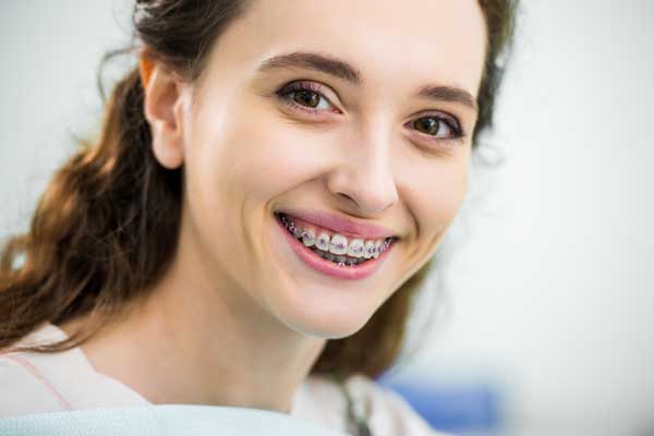 Image of a woman wearing dental braces at Aspen Orthodontics in Gilbert, Arizona